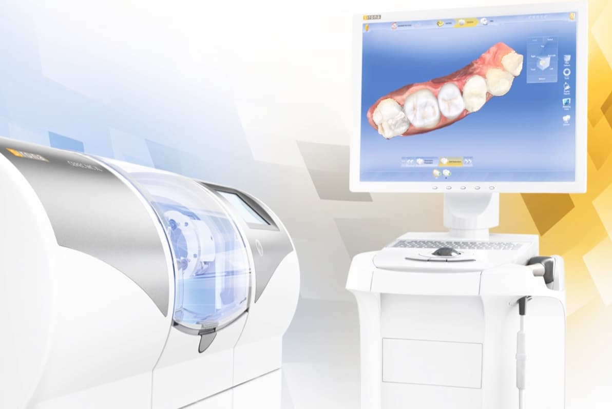 cerec.jpg